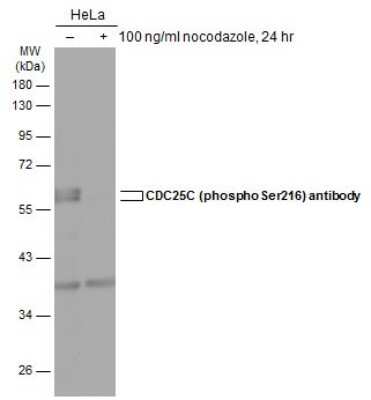 Western Blot: CDC25C [p Ser216] Antibody [NBP3-12879]